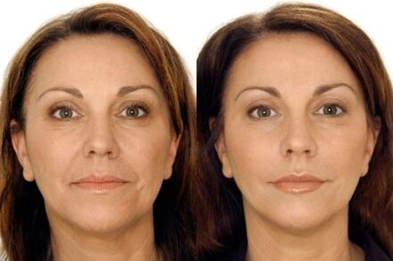 Face ging massage before and after